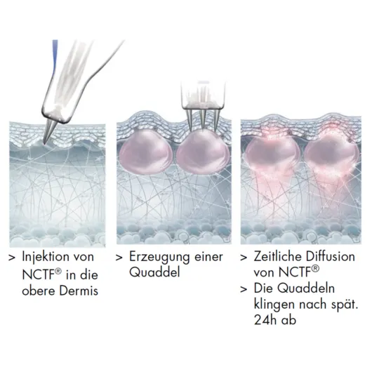 Nanosoft Bild